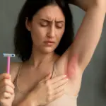 Perché la pelle si irrita dopo la depilazione? Le cause nascoste e come evitarle facilmente